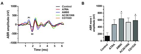 Comparison of ABR response amplitude, test time, and estimation of.